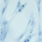 Fibroblastos, células del tejido conectivo, al microscopio óptico (MO). Tinción con azul de metileno. 400 x.