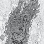 Fibroblasto al microscopio electrónico de transmisión (MET). 7.000 x.