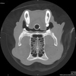 Diagnose mit Computertomographie