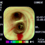 Diagnose mit Endoskopie