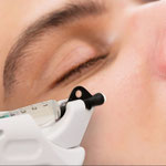 Infuzion System – Filler Effekt für sichtbar mehr Volumen und strahlendes Hautbild im Kosmetikinstitut Villa Kirnach