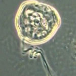 Glockentierchen (Vorticella spec.)