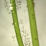 Glockentierchen (Vorticella spec.) auf Quirlen-Ästen von Armleuchteralgen