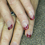 Gel