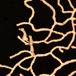 Seepferdchen Denisi, sogar ein schwangerer Herr, die Dame kehrt den Tücken