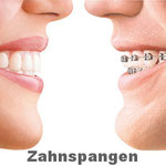 Zahnspangen