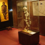 „Lucy“ (140 cm) im National Museum von Addis Abeba