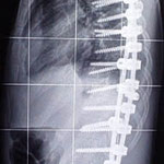 Röntgenbild von der Seite