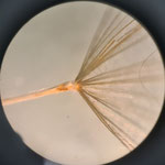 Bocksbart (Ansatz des Schirmchens)