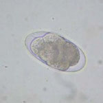 Detalle de un huevo de Strongylus (parásito intestinal) en un análisis coprológico