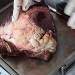 Die Anatomie des Herzens