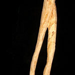 o.T.,  86 cm mit Sockel, Platane