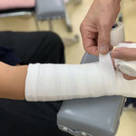 １０代の骨癒合は早く2週が経過していたので前腕のみの固定に変更　保存療法　国分寺こみね鍼灸整骨院