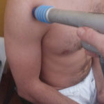 Aplicación ondas de choque radiales en tendinopatía del biceps braquial