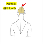 顔が長い 頭頂が尖がる なぜ顔が長くなるのか 生まれつきなのか 諦めなければ顔は短くできます