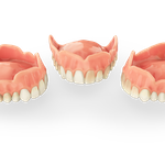 Vollprothese aus dem 3D Drucker für den Zahnersatzt