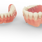 Vollprothese aus dem 3D Drucker für den Zahnersatzt