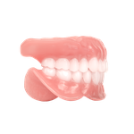 Gebiss Vollprothese aus dem 3D Drucker für den Zahnersatzt