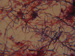 cauchi_diversite_dysfonctionnement_biologique_epuration_boue_activee_biomasse_assainissement_analyses_microscopiques_expertises_microbiologiques_bacterie_filament