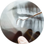 Fragen zu Implantaten und Antworten von Dr. Siuosh Rassaf, Zahnarzt in Frankfurt-Niederrad