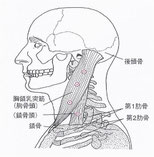 トリガーポイント図