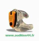 chasse, tir, protégeons nous les oreilles