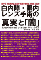 白内障・眼内レンズ手術の真実と「闇」