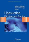 Shiffman: Liposuction Principles and Practice