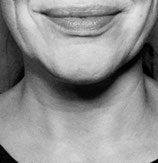 Mond en Lippen