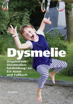 Dysmelie - Angeborene Gliedmaßenfehlbildung/-en. Ein Hand- und Fußbuch