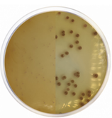 Agar Cromogénico Burkholderia Cepacia c/500 g CONDALAB 2142