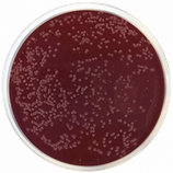 Base de Agar Campylobacter (Preston) c/500 gr Condalab 1131