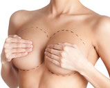 Breast Reduction 