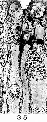 Fig. 35 (= IH/2/17): Querschliff; Frühholz mit ausschließlich sklerotischen Thyllen.