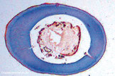 Mikroskopische Aufnahme des Querschnitts einer Antenne. Sehr schön kann man die Leibesflüssigkeit (Hämolymphe) in der Mitte erkennen. Die blau gefärbten Bereiche zeigen die Wandung des Fühlers, die mehrschichtige Cuticula.