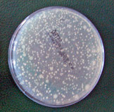 Gewässer mit geringer Keimdichte weisen im Nachweis auf einer Agarplatte wenige Bakterienkolonien auf. Foto: Dr. Sandra Lechleiter