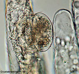 Angeheftete Zyste eines Protozoen an der Kiemenoberfläche. 