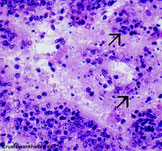 Querschnitt des lymphatischen Organs einer juvenilen P. monodon mit akuter YHD, 525fach vergrößert. Färbung nach H.& E.Mayer-Bennett.