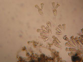 cauchi_epistylis_dysfonctionnement_biologique_epuration_boue_activee_biomasse_assainissement_analyses_microscopiques_expertises_microbiologiques_bacterie_filament