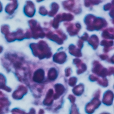 edorrhinum-Nosode - Erbnosode - bei Schleimhautentzündungen der Harn- und Geschlechtsorgane, der Atemwege und des Magen-Darm-Kanals, enthalten in metabiarex®N und metabiarex®S Inj.