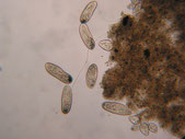 cauchi_paramecie_dysfonctionnement_biologique_epuration_boue_activee_biomasse_assainissement_analyses_microscopiques_expertises_microbiologiques_bacterie_filament