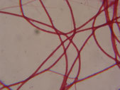 cauchi_021N_dysfonctionnement_biologique_epuration_boue_activee_biomasse_assainissement_analyses_microscopiques_expertises_microbiologiques_bacterie_filament