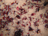 cauchi_microthrix_dysfonctionnement_biologique_epuration_boue_activee_biomasse_assainissement_analyses_microscopiques_expertises_microbiologiques_bacterie_filament