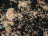 cauchi_nocardia_dysfonctionnement_biologique_epuration_boue_activee_biomasse_assainissement_analyses_microscopiques_expertises_microbiologiques_bacterie_filament