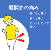 股関節の痛みと原因と創健堂の施術