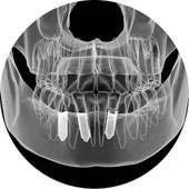 3D-Röntgenaufnahme eines Kiefers