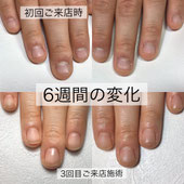 春ネイル　リボンネイル　大人可愛い　定額ネイルオフ無料松山ネイルサロン　オフィス