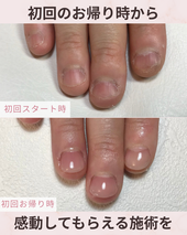 春ネイル　リボンネイル　大人可愛い　定額ネイルオフ無料松山ネイルサロン　オフィス