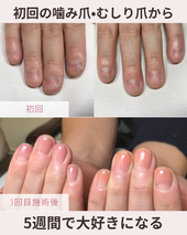 春ネイル　　キラキラ　大人可愛い　　定額松山市ネイル