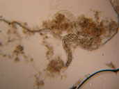 cauchi_nematode_dysfonctionnement_biologique_epuration_boue_activee_biomasse_assainissement_analyses_microscopiques_expertises_microbiologiques_bacterie_filament